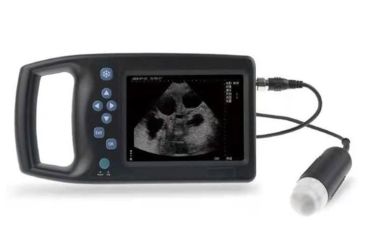 BU10x Handheld Tipe B Ultrasoniese Skandeerder BU101